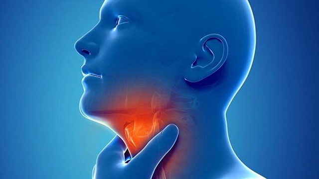 Viêm họng cấp tính tái đi tái lại, kéo dài nhiều ngày được gọi là viêm họng mãn tính